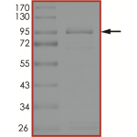 EGFR (K716A T790M C797S L858R), Active